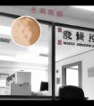 小孩白斑病是怎么得来的原因图片